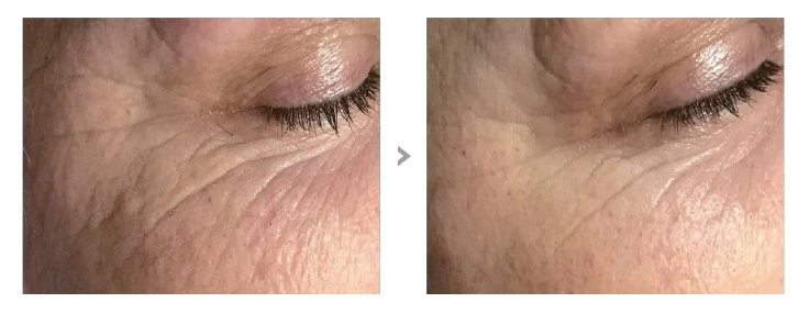 Oczyszczanie wodorowe